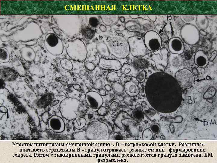 СМЕШАННАЯ КЛЕТКА Участок цитоплазмы смешанной ацино -, В – островковой клетки. Различная плотность сердцевины
