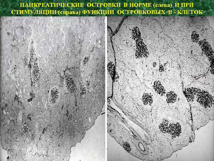 ПАНКРЕАТИЧЕСКИЕ ОСТРОВКИ В НОРМЕ (слева) И ПРИ СТИМУЛЯЦИИ (справа) ФУНКЦИИ ОСТРОВКОВЫХ В - КЛЕТОК