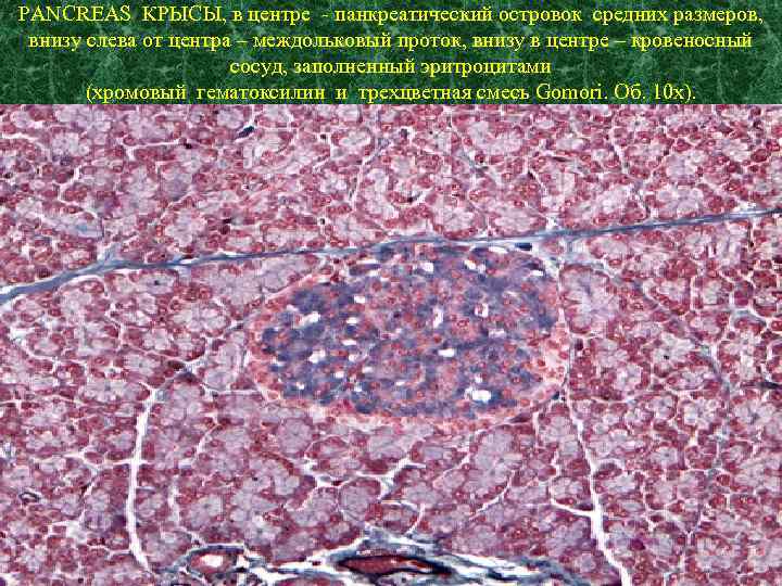 PANCREAS КРЫСЫ, в центре - панкреатический островок средних размеров, внизу слева от центра –