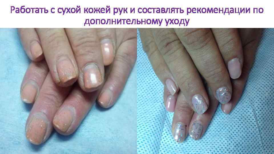 Работать с сухой кожей рук и составлять рекомендации по дополнительному уходу 
