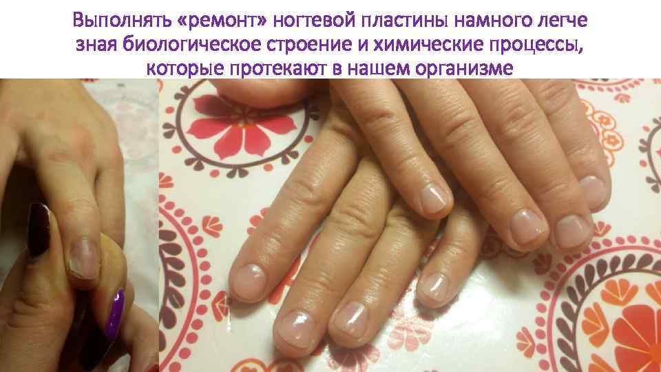 Выполнять «ремонт» ногтевой пластины намного легче зная биологическое строение и химические процессы, которые протекают