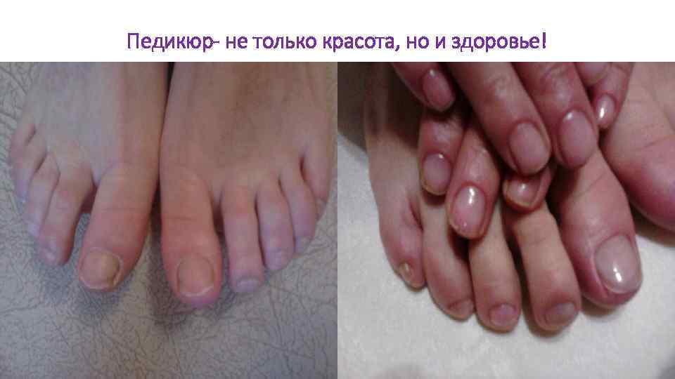 Педикюр- не только красота, но и здоровье! 