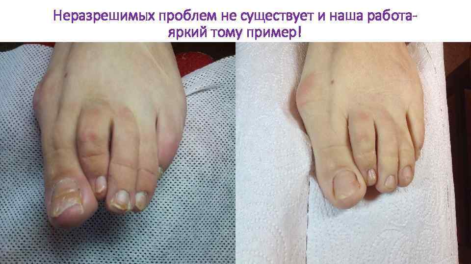 Неразрешимых проблем не существует и наша работаяркий тому пример! 