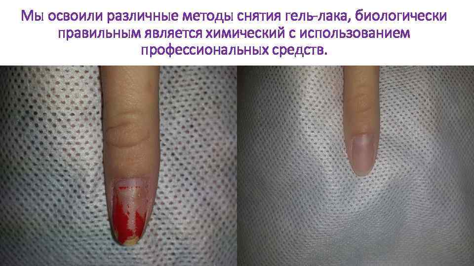 Мы освоили различные методы снятия гель-лака, биологически правильным является химический с использованием профессиональных средств.