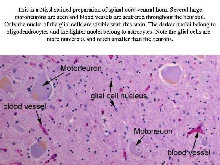 This is a Nissl stained preparation of spinal cord ventral horn. Several large motoneurons