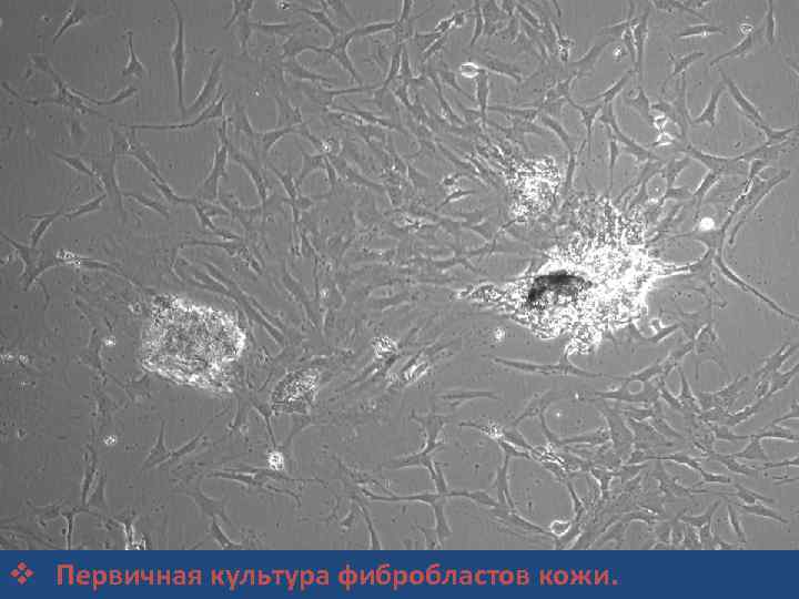 v Первичная культура фибробластов кожи. 