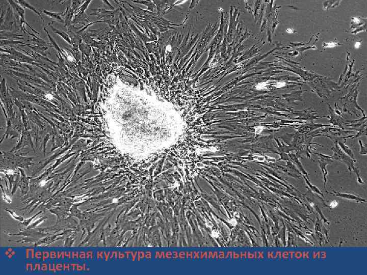 v Первичная культура мезенхимальных клеток из плаценты. 