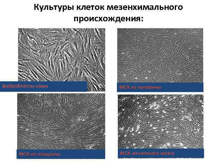 Культуры клеток мезенхимального происхождения: фибробласты кожи МСК из плаценты МСК из пуповины МСК из