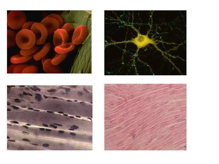 Клетки крови (эритроциты) Клетки скелетной поперечно полосатой мышечной ткани Нервная клетка Клетки гладкой мышечной