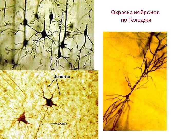 Окраска нейронов по Гольджи 