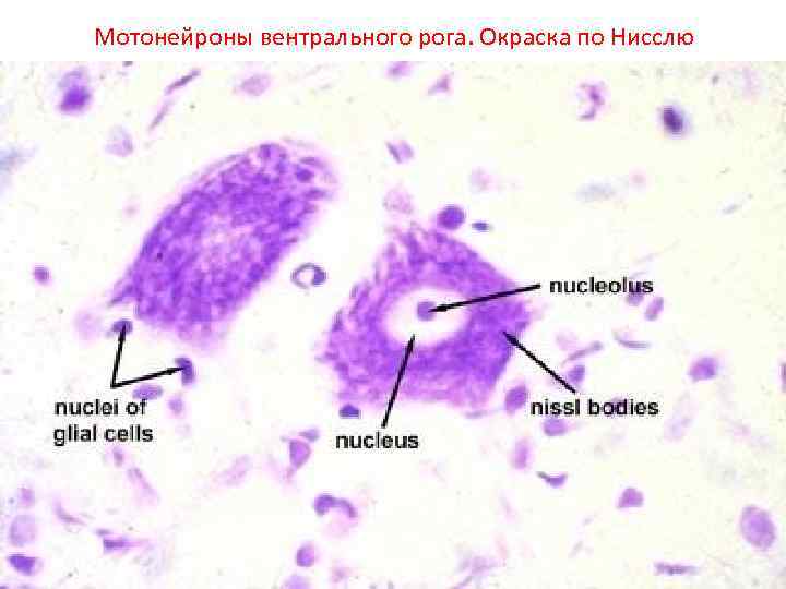 Мотонейроны вентрального рога. Окраска по Нисслю 