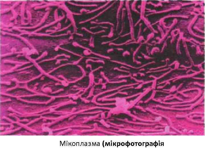 Мікоплазма (мікрофотографія 