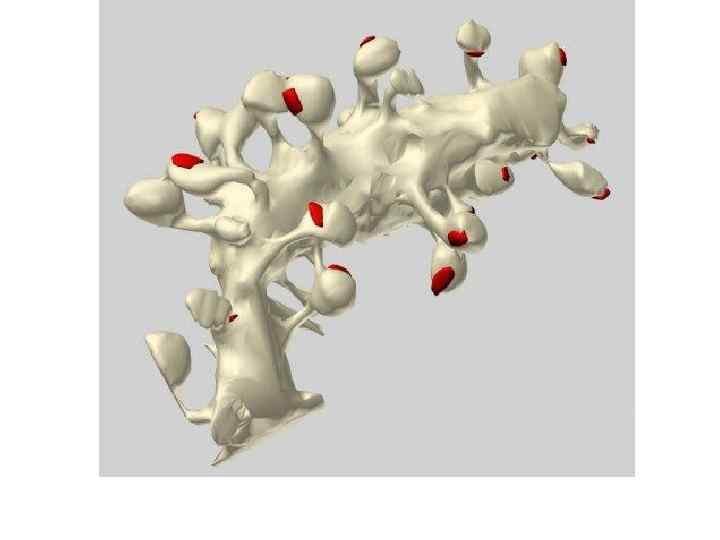 Многочисленные булавовидные шипики на ветви дендрита клетки Пуркинье в коре мозжечка мыши 