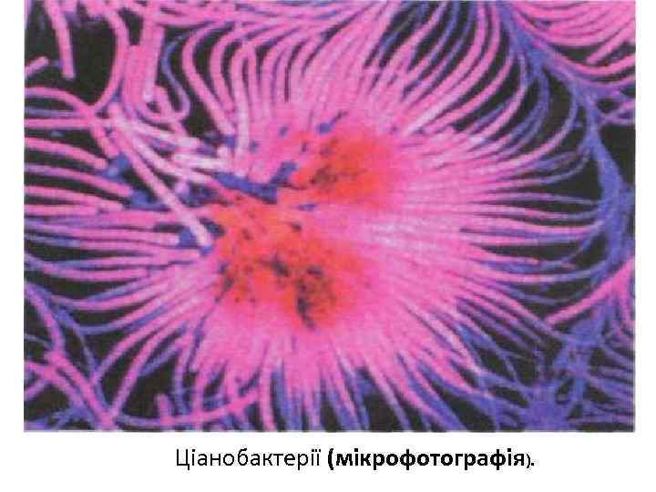 Ціанобактерії (мікрофотографія). 