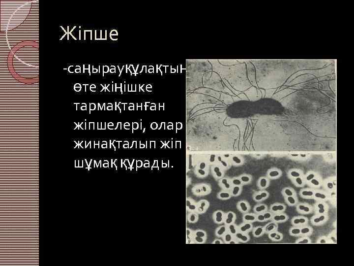 Жіпше -саңырауқұлақтың өте жіңішке тармақтанған жіпшелері, олар жинақталып жіп шұмақ құрады. 