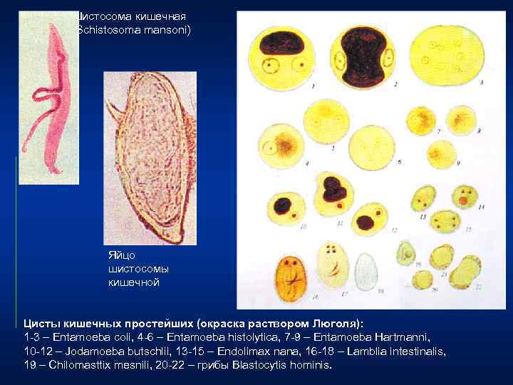 Простейшие в кале лечение. Schistosoma mansoni яйца. Яйцо кишечной шистосомы. Яйца шистосомы кровяной. Schistosoma mansoni яйца Размеры.
