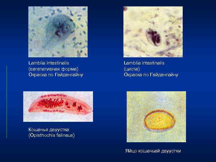 Lamblia intestinalis (вегетативная форма) Окраска по Гейденгайну Lamblia intestinalis (циста) Окраска по Гейденгайну Кошачья