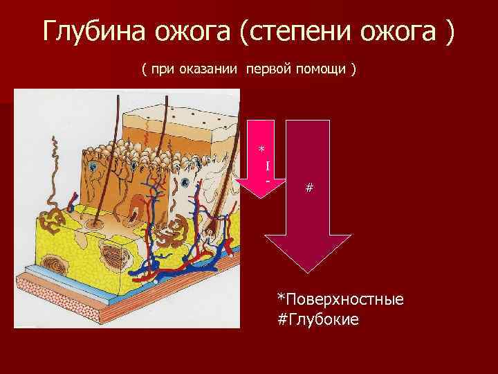 Глубина ожога (степени ожога ) ( при оказании первой помощи ) * I -