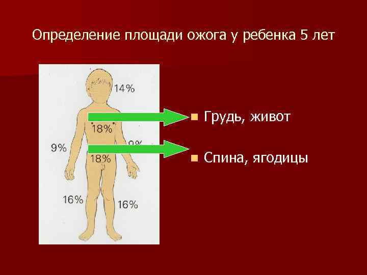 Определение площади ожога у ребенка 5 лет n Грудь, живот n Спина, ягодицы 