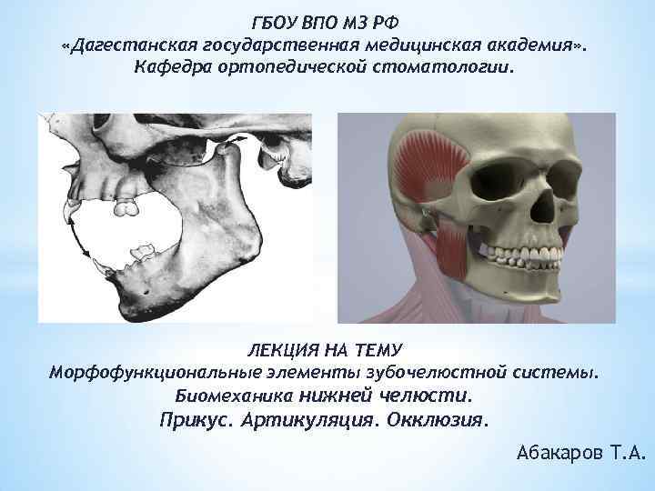 ГБОУ ВПО МЗ РФ «Дагестанская государственная медицинская академия» . Кафедра ортопедической стоматологии. ЛЕКЦИЯ НА