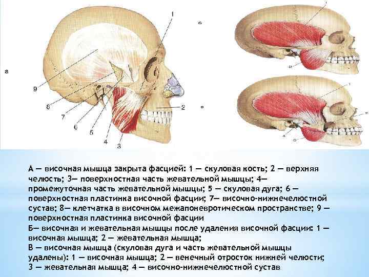 А — височная мышца закрыта фасцией: 1 — скуловая кость; 2 — верхняя челюсть;