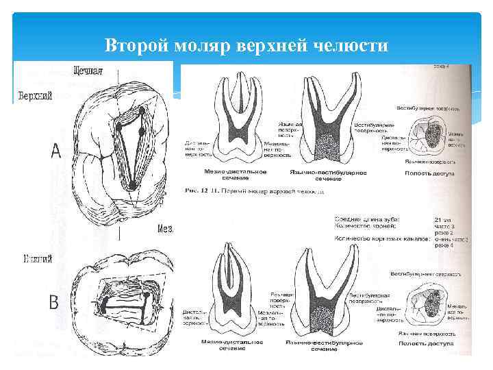 Второй моляр верхней челюсти 