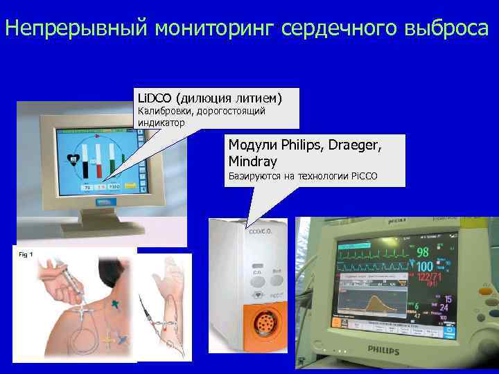 Непрерывный мониторинг сердечного выброса Li. DCO (дилюция литием) Калибровки, дорогостоящий индикатор Модули Philips, Draeger,