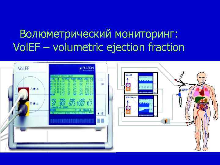 Волюметрический мониторинг: Vol. EF – volumetric ejection fraction 