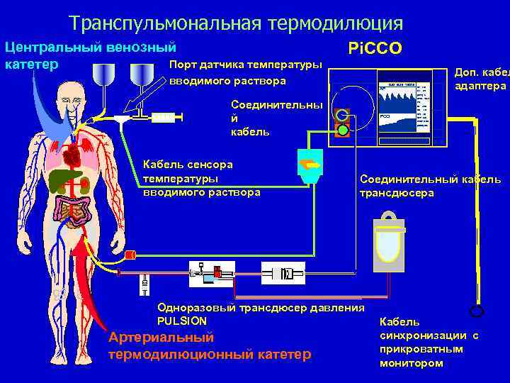 Транспульмональная термодилюция Центральный венозный Порт датчика температуры катетер Pi. CCO вводимого раствора AP 13.
