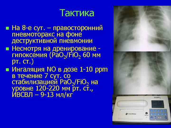 Тактика n n n На 8 -е сут. – правосторонний пневмоторакс на фоне деструктивной