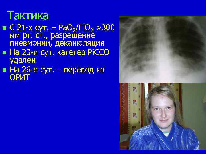 Тактика n n n C 21 -х сут. – Pa. O 2/Fi. O 2