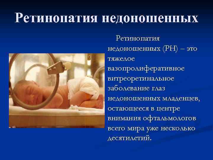 Ретинопатия недоношенных (РН) – это тяжелое вазопролиферативное витреоретинальное заболевание глаз недоношенных младенцев, остающееся в