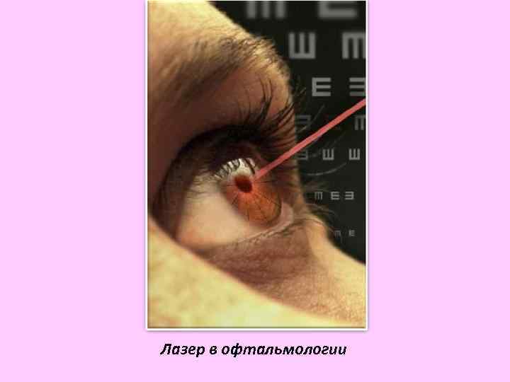 Лазер в офтальмологии 