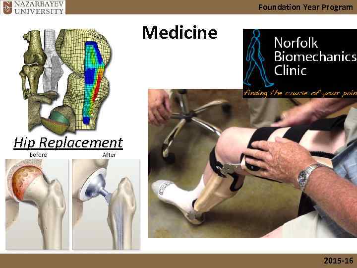 Foundation Year Program Medicine Hip Replacement 2015 -16 