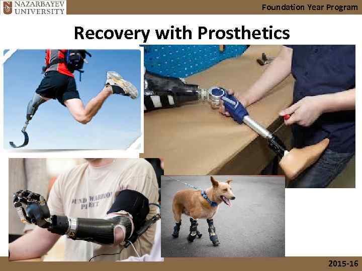 Foundation Year Program Recovery with Prosthetics 2015 -16 