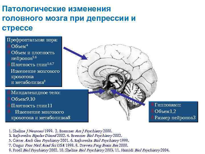 Патологические изменения головного мозга при депрессии и стрессе Префронтальная кора: òОбъем 4 òОбъем и