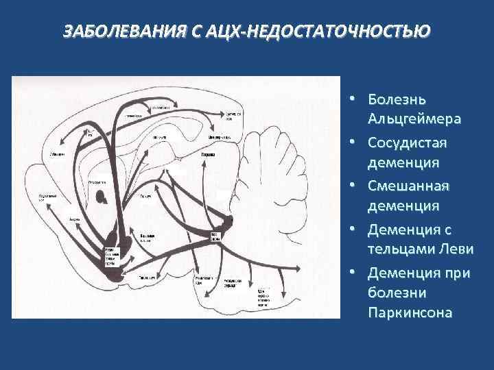 ЗАБОЛЕВАНИЯ С АЦХ-НЕДОСТАТОЧНОСТЬЮ • Болезнь Альцгеймера • Сосудистая деменция • Смешанная деменция • Деменция