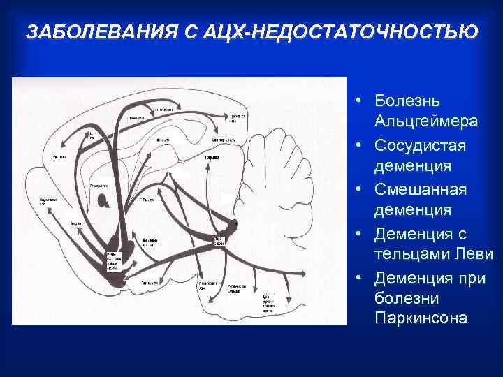 ЗАБОЛЕВАНИЯ С АЦХ-НЕДОСТАТОЧНОСТЬЮ • Болезнь Альцгеймера • Сосудистая деменция • Смешанная деменция • Деменция