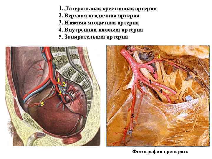 1. Латеральные крестцовые артерии 2. Верхняя ягодичная артерия 3. Нижняя ягодичная артерия 4. Внутренняя