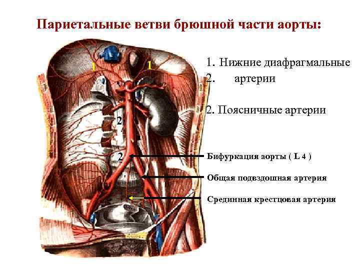 Аорта брюшной полости картинки