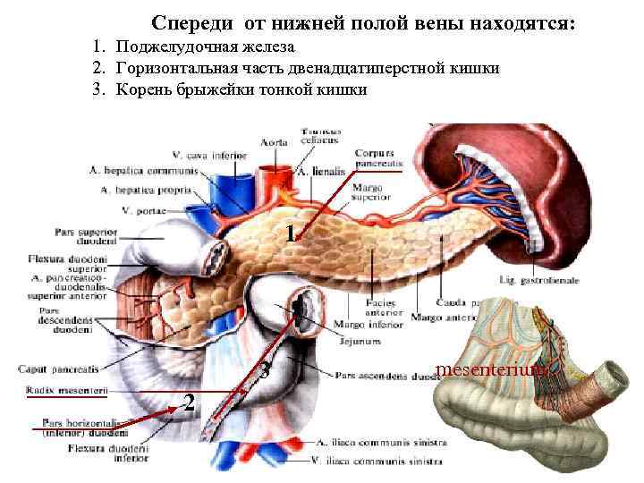 Корень брыжейки тонкой кишки. Поджелудочная железа и нижняя полая Вена. Поджелудочно двенадцатиперстная Вена. Вена поджелудочной железы. Брыжейка двенадцатиперстной кишки.