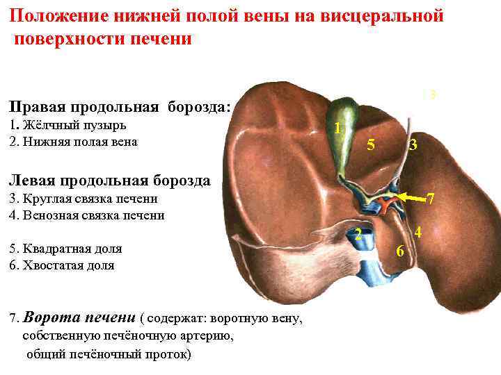 Положение нижней полой вены на висцеральной поверхности печени 3 Правая продольная борозда: 1. Жёлчный