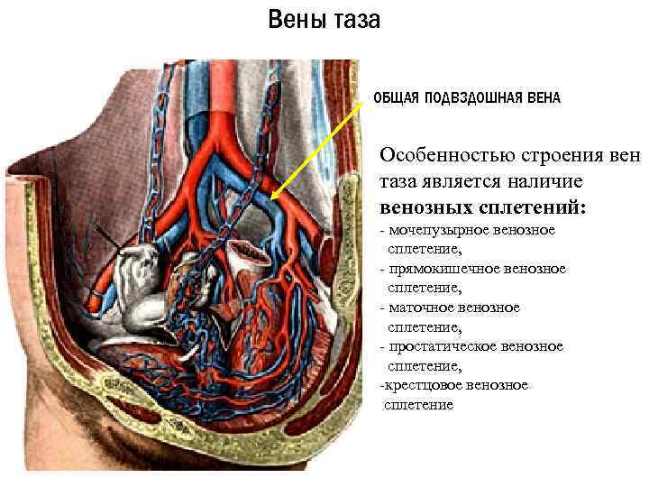 Венозные сплетения малого таза у женщин. Левая наружная подвздошная Вена. Внутренняя подвздошная Вена топография. Наружная подвздошная Вена топография. Подвздошная Вена анатомия.