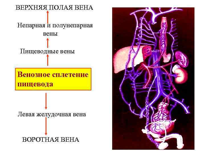 ВЕРХНЯЯ ПОЛАЯ ВЕНА Непарная и полунепарная вены Пищеводные вены Венозное сплетение пищевода Левая желудочная