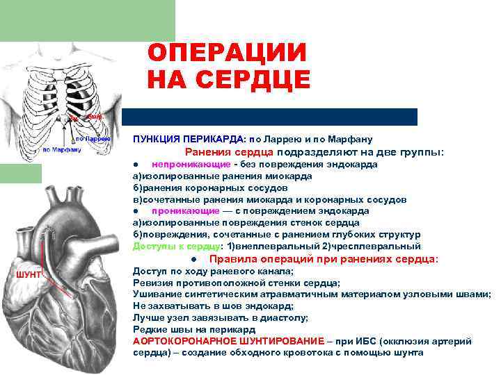 ОПЕРАЦИИ НА СЕРДЦЕ ПУНКЦИЯ ПЕРИКАРДА: по Ларрею и по Марфану Ранения сердца подразделяют на