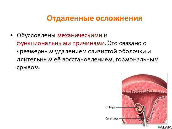 Отдаленные осложнения • Обусловлены механическими и функциональными причинами. Это связано с чрезмерным удалением слизистой