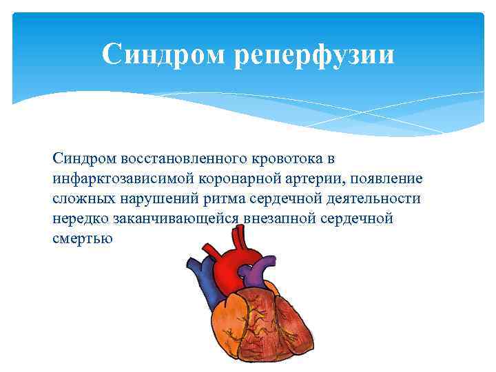 Синдром реперфузии Синдром восстановленного кровотока в инфарктозависимой коронарной артерии, появление сложных нарушений ритма сердечной