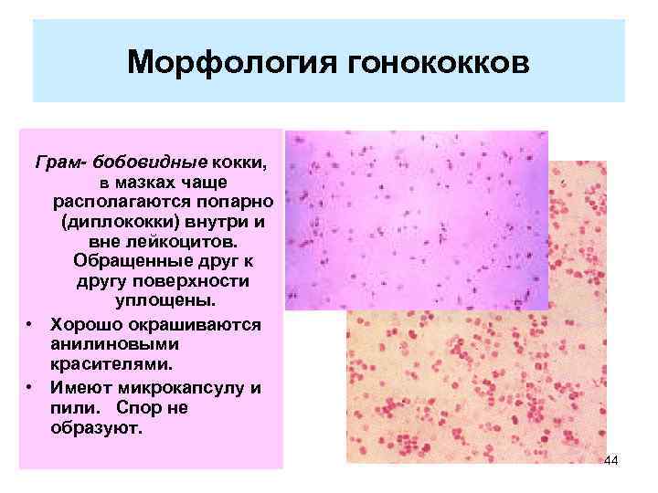 Морфология гонококков Грам- бобовидные кокки, в мазках чаще располагаются попарно (диплококки) внутри и вне