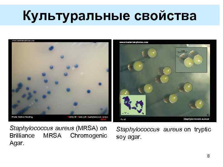 Культуральные свойства Staphylococcus aureus (MRSA) on Brilliance MRSA Chromogenic Agar. Staphylococcus aureus on tryptic