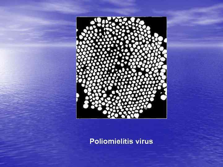 Poliomielitis virus 